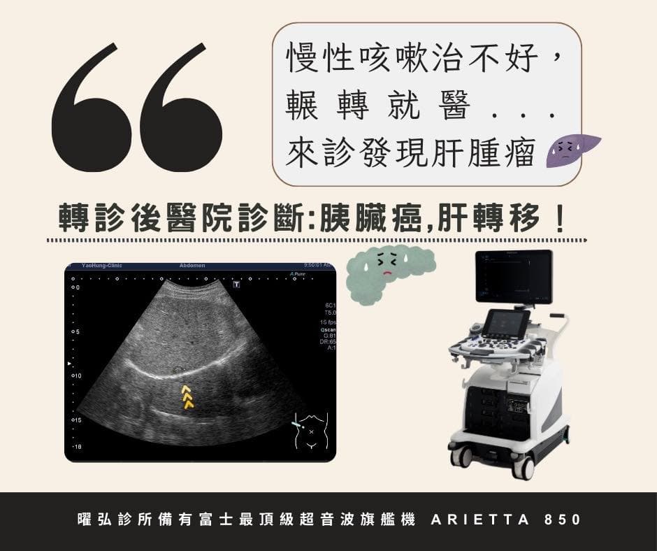 【真實案例】慢性咳嗽治不好,他輾轉求醫最後竟診斷出胰臟癌