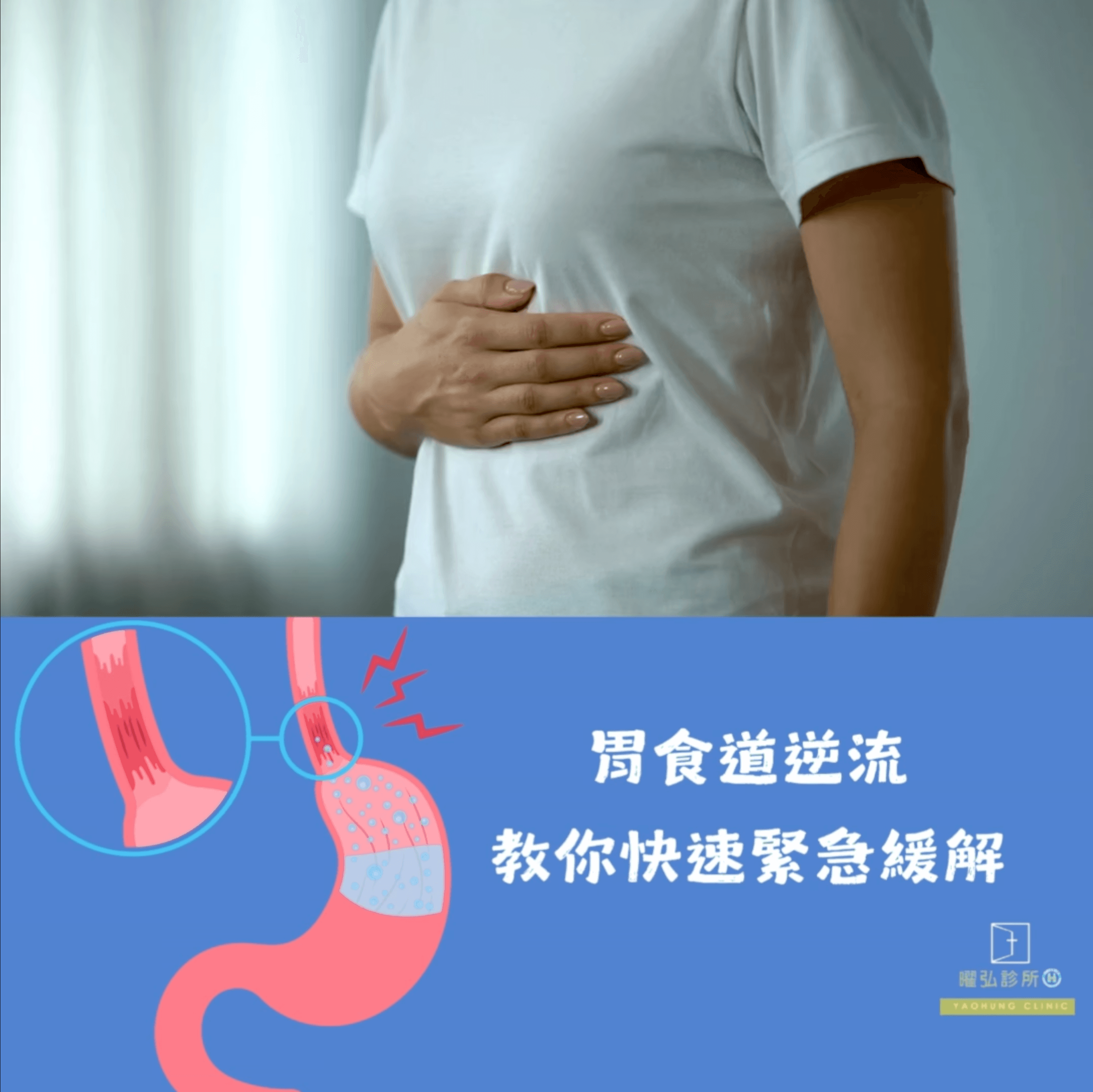 胃食道逆流,正確的就醫才能有效對症下藥解決問題